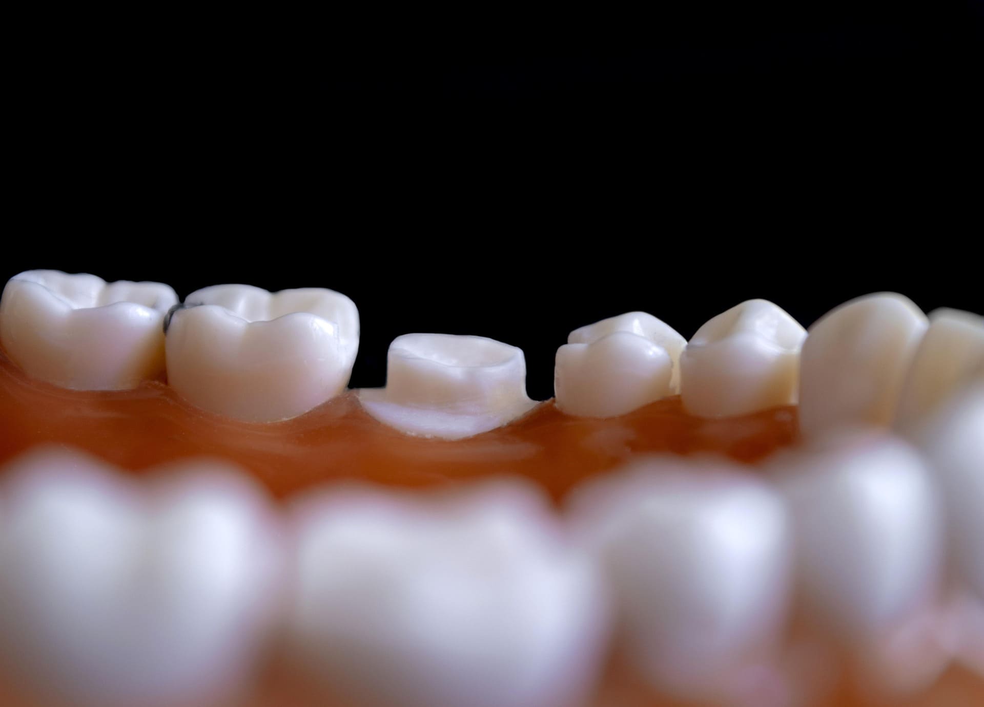 Cuando es importante ir al dentista